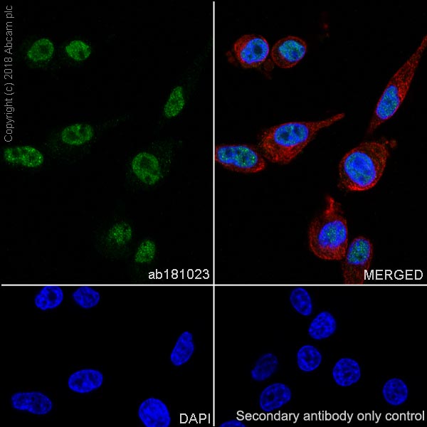 Immunocytochemistry/ Immunofluorescence - Anti-Choline Acetyltransferase antibody [EPR13024(B)] - BSA and Azide free (AB224267), expandable thumbnail