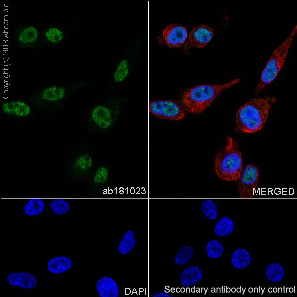 Immunocytochemistry/ Immunofluorescence - Anti-Choline Acetyltransferase antibody [EPR13024(B)] - BSA and Azide free (AB224267)