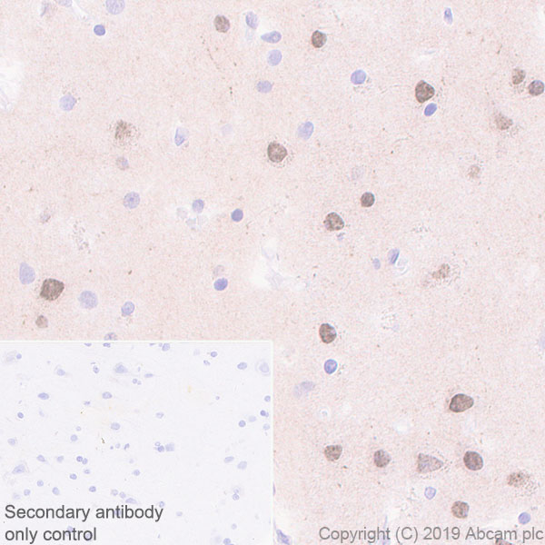 Immunohistochemistry (Formalin/PFA-fixed paraffin-embedded sections) - Anti-Choline Acetyltransferase antibody [EPR13024(B)] - BSA and Azide free (AB224267), expandable thumbnail