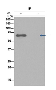Immunoprecipitation - Anti-Choline Acetyltransferase antibody [EPR13024(B)] - BSA and Azide free (AB224267), expandable thumbnail