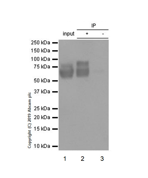 Immunoprecipitation - Anti-Choline Acetyltransferase antibody [EPR13024(B)] - BSA and Azide free (AB224267), expandable thumbnail