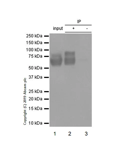 Immunoprecipitation - Anti-Choline Acetyltransferase antibody [EPR13024(B)] - BSA and Azide free (AB224267)