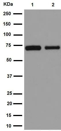 Western blot - Anti-Choline Acetyltransferase antibody [EPR16590] (AB178850)