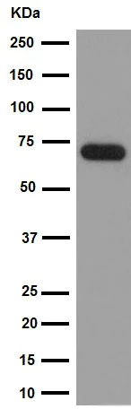 Western blot - Anti-Choline Acetyltransferase antibody [EPR16590] (AB178850)