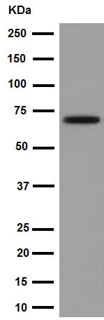 Western blot - Anti-Choline Acetyltransferase antibody [EPR16590] (AB178850)