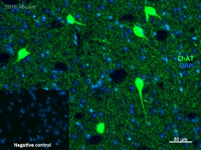Immunohistochemistry (Formalin/PFA-fixed paraffin-embedded sections) - Anti-Choline Acetyltransferase antibody [EPR16590] - BSA and Azide free (AB221793), expandable thumbnail