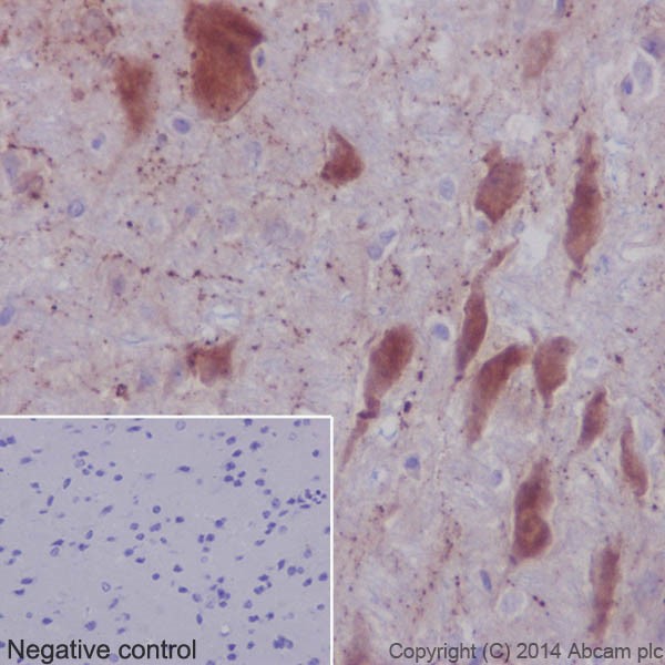 Immunohistochemistry (Formalin/PFA-fixed paraffin-embedded sections) - Anti-Choline Acetyltransferase antibody [EPR16590] - BSA and Azide free (AB221793), expandable thumbnail