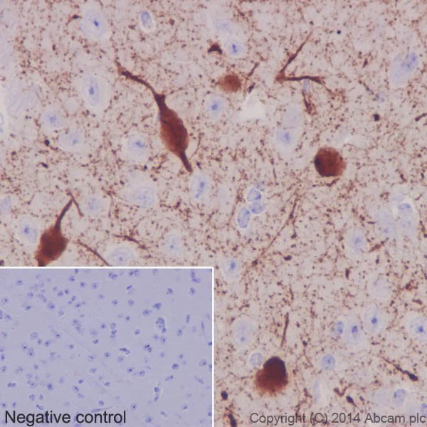 Immunohistochemistry (Formalin/PFA-fixed paraffin-embedded sections) - Anti-Choline Acetyltransferase antibody [EPR16590] - BSA and Azide free (AB221793)