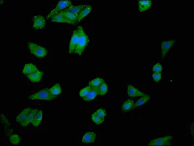 Immunocytochemistry/ Immunofluorescence - Anti-Choline kinase alpha antibody (AB235938)