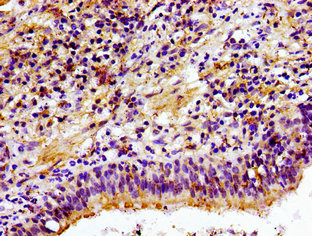 Immunohistochemistry (Formalin/PFA-fixed paraffin-embedded sections) - Anti-Choline kinase alpha antibody (AB235938), expandable thumbnail