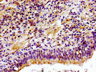 Immunohistochemistry (Formalin/PFA-fixed paraffin-embedded sections) - Anti-Choline kinase alpha antibody (AB235938)
