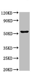 Western blot - Anti-Choline kinase alpha antibody (AB235938), expandable thumbnail