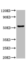 Western blot - Anti-Choline kinase alpha antibody (AB235938)