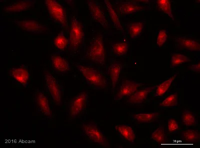 Immunocytochemistry/ Immunofluorescence - Anti-Choline kinase alpha antibody (AB88053)