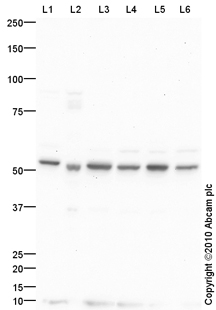 Anti-Choline kinase alpha antibody