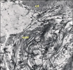 Electron Microscopy - Anti-Chondroitin Sulfate antibody [CS-56] (AB11570)