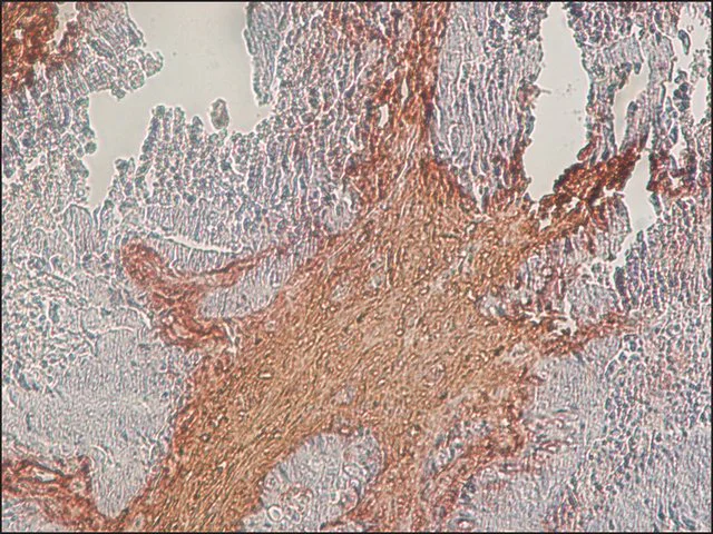 Immunohistochemistry (Formalin/PFA-fixed paraffin-embedded sections) - Anti-Chondroitin Sulfate antibody [CS-56] (AB11570)