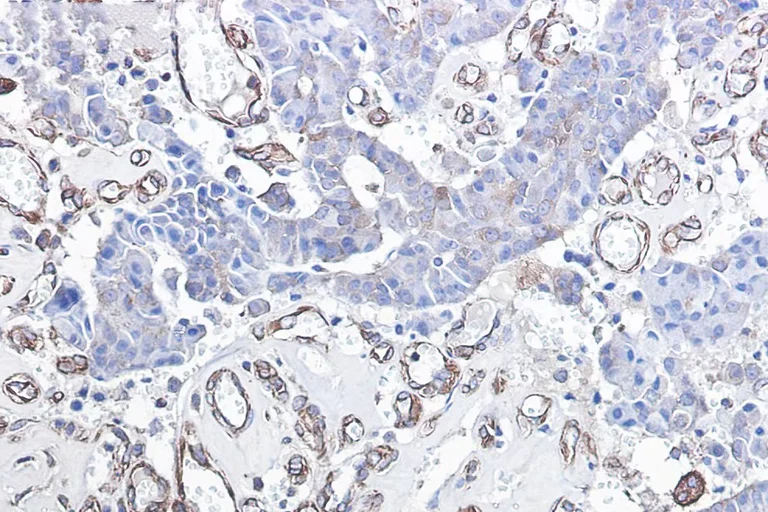 Immunohistochemistry (Formalin/PFA-fixed paraffin-embedded sections) - Anti-CHOP Antibody [S02-6A3] (AB317378)