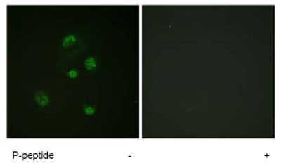 Immunocytochemistry/ Immunofluorescence - Anti-CHOP (phospho S30) antibody (AB63392)
