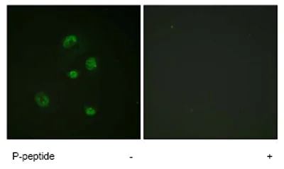 Immunocytochemistry/ Immunofluorescence - Anti-CHOP (phospho S30) antibody (AB63392)