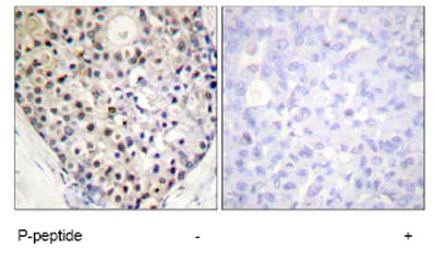 Immunohistochemistry (Formalin/PFA-fixed paraffin-embedded sections) - Anti-CHOP (phospho S30) antibody (AB63392)