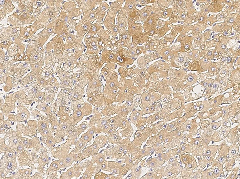 Immunohistochemistry (Formalin/PFA-fixed paraffin-embedded sections) - Anti-Chordin antibody (AB279579)