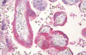 Immunohistochemistry (Formalin/PFA-fixed paraffin-embedded sections) - Anti-Chorionic Gonadotropin antibody (AB133210)