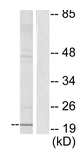 Western blot - Anti-Chorionic Gonadotropin antibody (AB133210)