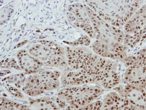 Immunohistochemistry (Formalin/PFA-fixed paraffin-embedded sections) - Anti-CHRAC-17 antibody (AB229060)