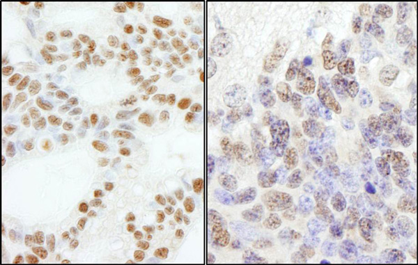 Immunohistochemistry (Formalin/PFA-fixed paraffin-embedded sections) - Anti-CHRAC-17 antibody (AB74308)