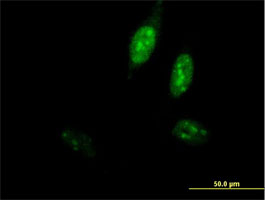 Immunocytochemistry/ Immunofluorescence - Anti-CHRAC-17 antibody (AB88521), expandable thumbnail