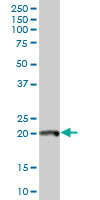 Western blot - Anti-CHRAC-17 antibody (AB88521), expandable thumbnail