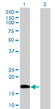 Western blot - Anti-CHRAC-17 antibody (AB88521), expandable thumbnail