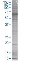 SDS-PAGE - CHRAC-17 overexpression 293T lysate (whole cell) (AB94037)