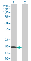 Western blot - CHRAC-17 overexpression 293T lysate (whole cell) (AB94037), expandable thumbnail