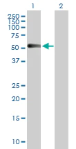 Western blot - Anti-CHRDL1 antibody (AB103369)