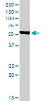 Western blot - Anti-CHRDL1 antibody (AB103369)