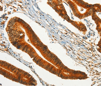 Immunohistochemistry (Formalin/PFA-fixed paraffin-embedded sections) - Anti-CHRDL2 antibody (AB198786)