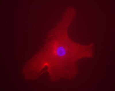 Immunocytochemistry/ Immunofluorescence - Anti-CHREBP antibody (AB92809), expandable thumbnail