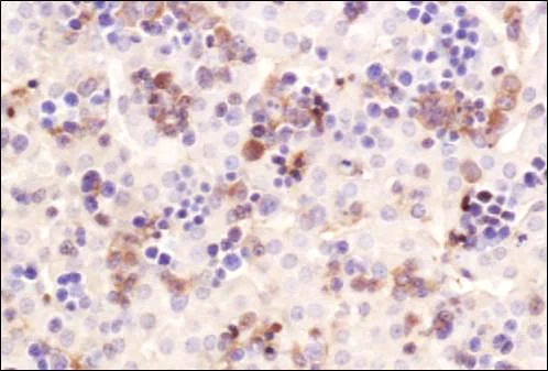Immunohistochemistry (Formalin/PFA-fixed paraffin-embedded sections) - Anti-CHREBP antibody (AB92809)