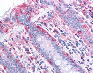 Immunohistochemistry (Formalin/PFA-fixed paraffin-embedded sections) - Anti-CHREBP antibody (AB92809)