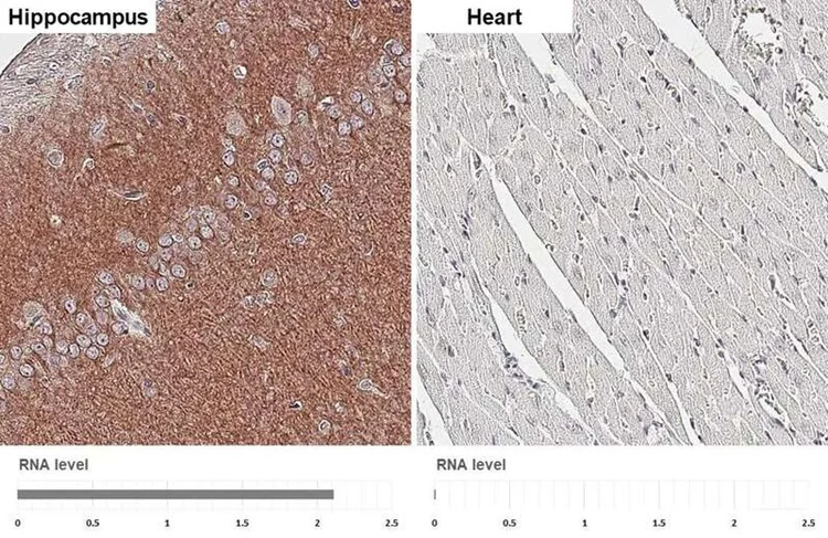 Immunohistochemistry (Formalin/PFA-fixed paraffin-embedded sections) - Anti-CHRM1 antibody [HL3933] - BSA and Azide free (AB325865)