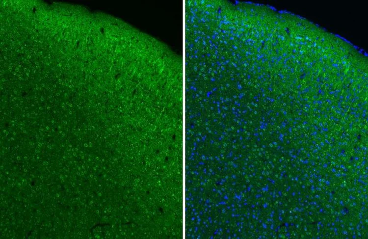Immunohistochemistry (Formalin/PFA-fixed paraffin-embedded sections) - Anti-CHRM1 antibody [HL3933] - BSA and Azide free (AB325865)