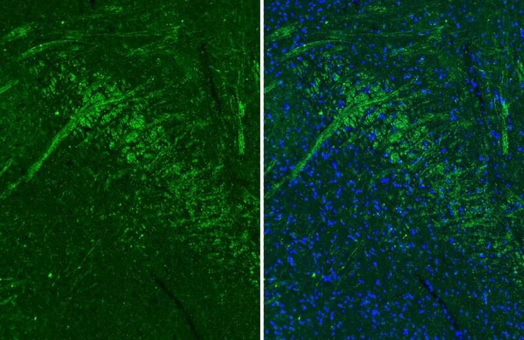 Immunohistochemistry (Formalin/PFA-fixed paraffin-embedded sections) - Anti-CHRM1 antibody [HL3933] - BSA and Azide free (AB325865)