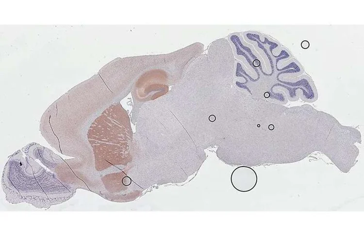 Immunohistochemistry (Formalin/PFA-fixed paraffin-embedded sections) - Anti-CHRM1 antibody [HL3933] - BSA and Azide free (AB325865)
