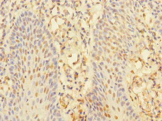 Immunohistochemistry (Formalin/PFA-fixed paraffin-embedded sections) - Anti-CHRNA10 antibody (AB234767)