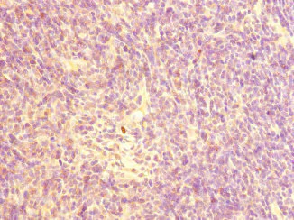 Immunohistochemistry (Formalin/PFA-fixed paraffin-embedded sections) - Anti-CHRNA10 antibody (AB234767)