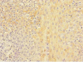 Immunohistochemistry (Formalin/PFA-fixed paraffin-embedded sections) - Anti-CHRNA2 antibody (AB230287)