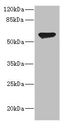 Western blot - Anti-CHRNA2 antibody (AB230287)