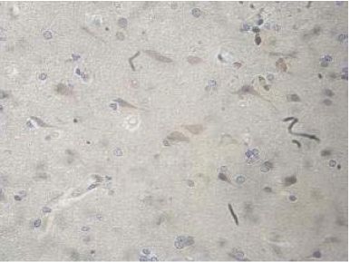 Immunohistochemistry (Formalin/PFA-fixed paraffin-embedded sections) - Anti-CHRNA9 antibody (AB177119)